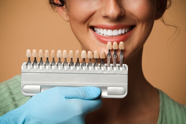 How Long Do Veneers Last? Tips For Maintaining Your New Smile